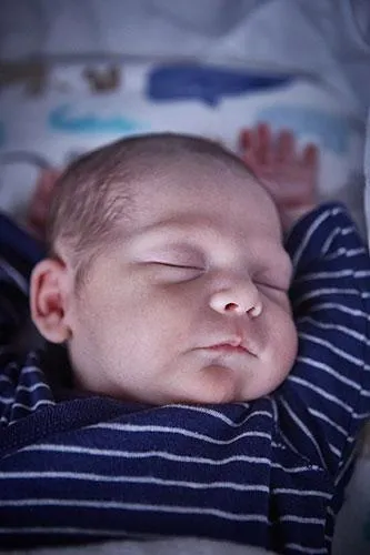 7 Caracteristicas de la Inflamacion Cronica y Como Aliviarla de Forma Natural image 3